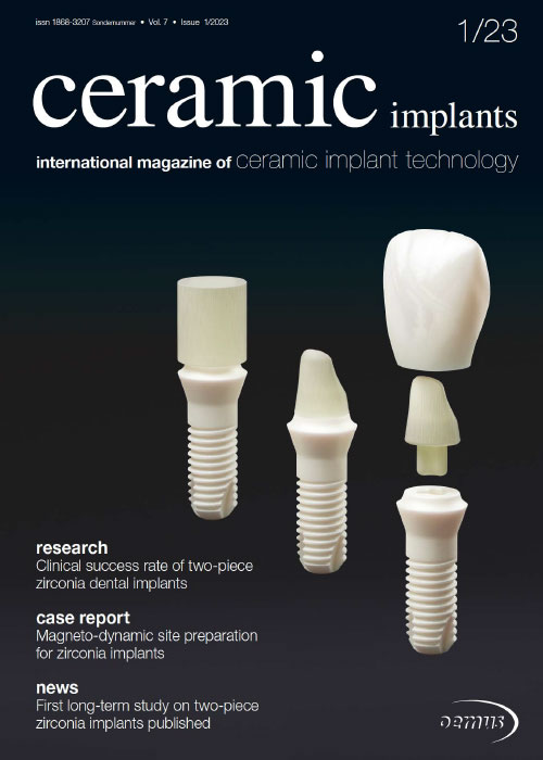 Fachinformationen – ceramic implants 1/2023